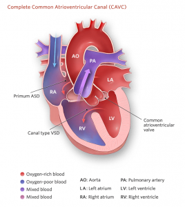 Common heart defects Archives – SujyotHeartClinic