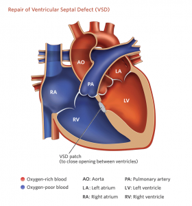 Adult 2D echo with GLS – SujyotHeartClinic